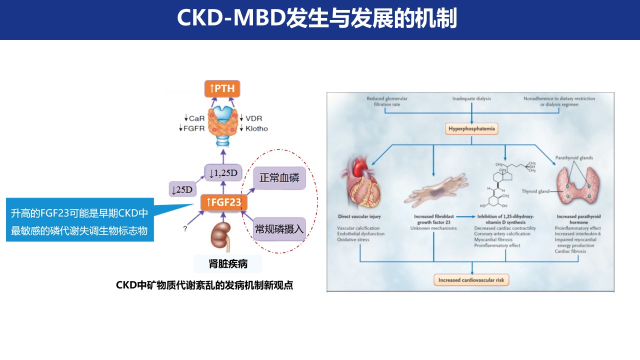 肾脏疾病中防治钙磷沉积的新策略:聚焦血管钙化防御_葛永纯_2023_幻灯_中华医学会肾脏病学分会